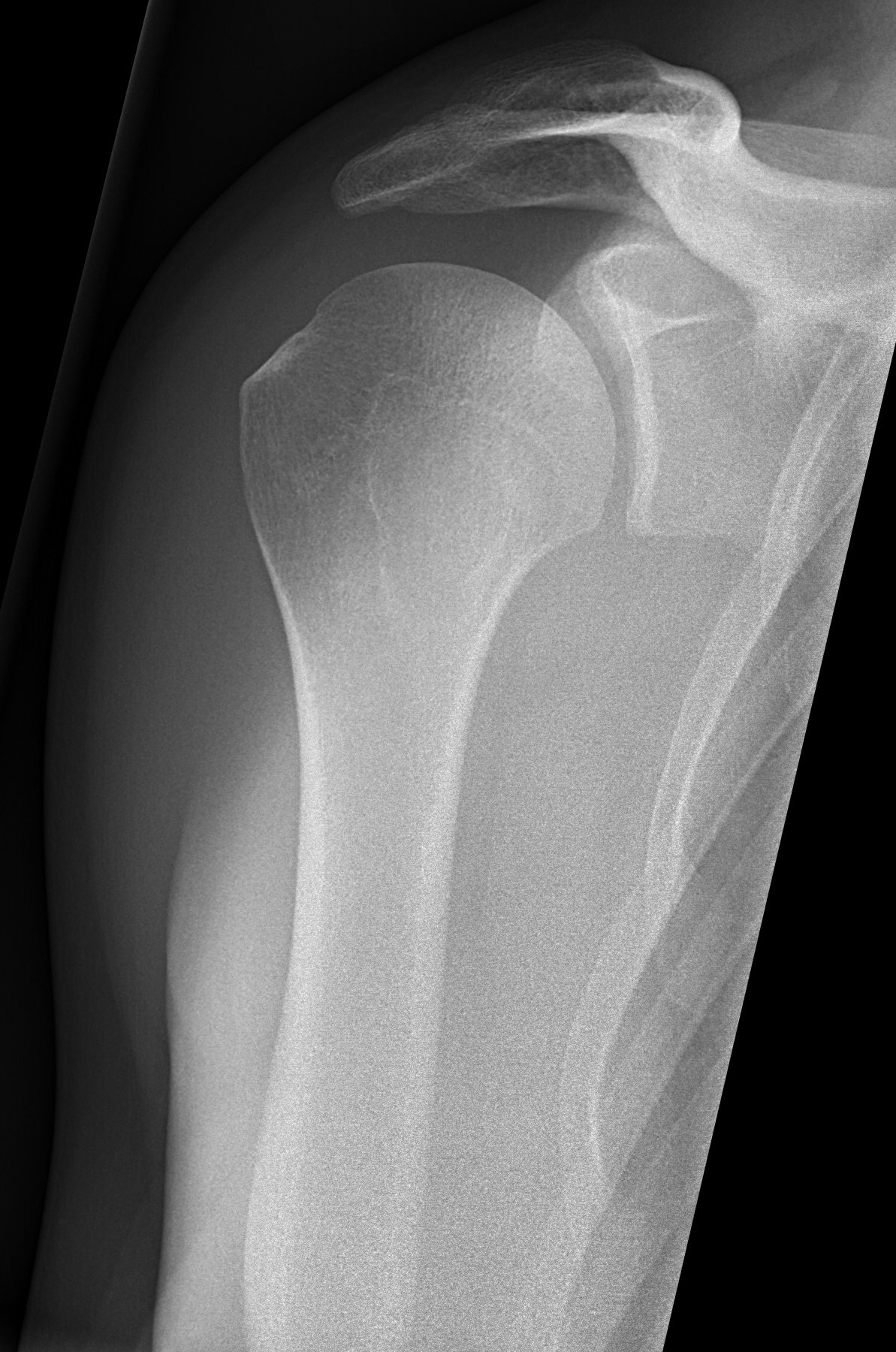 Radiograph of the shoulder