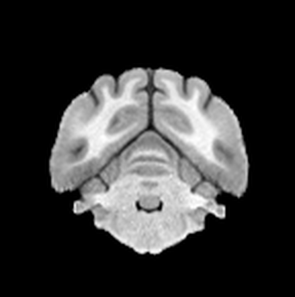 T1 MRI atlas of the canine brain